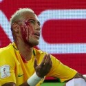 (FOTO) Neymar muestra su cara días después de violento codazo
